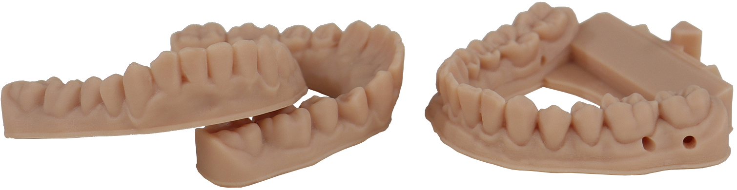 Impresión 3D de modelos dentales precisos y modelos de alineadores con  resina