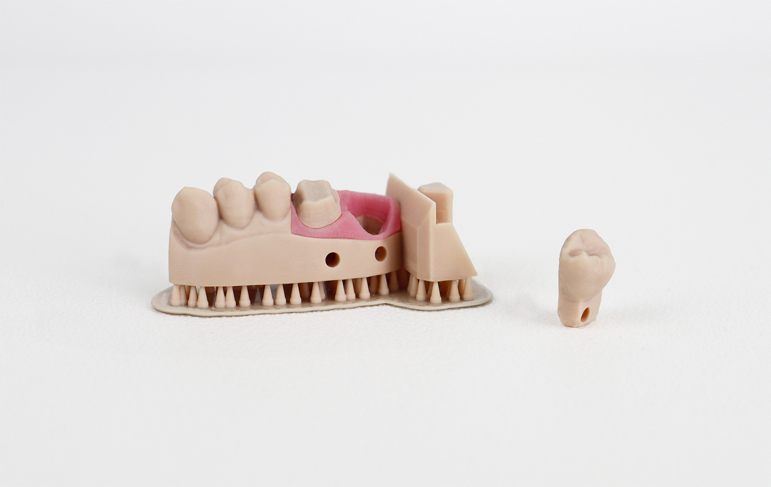 Caso d'uso Modello dentale Modello parziale beige con Gingiva Mask Resina per la stampa 3D SLA DLP LCD MSLA