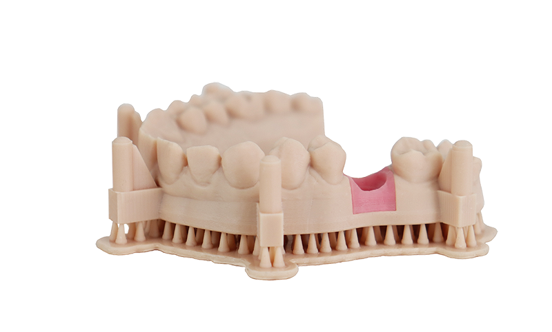 Use case Dental Model Beige with signal implant Resin for SLA DLP LCD MSLA 3D Printing