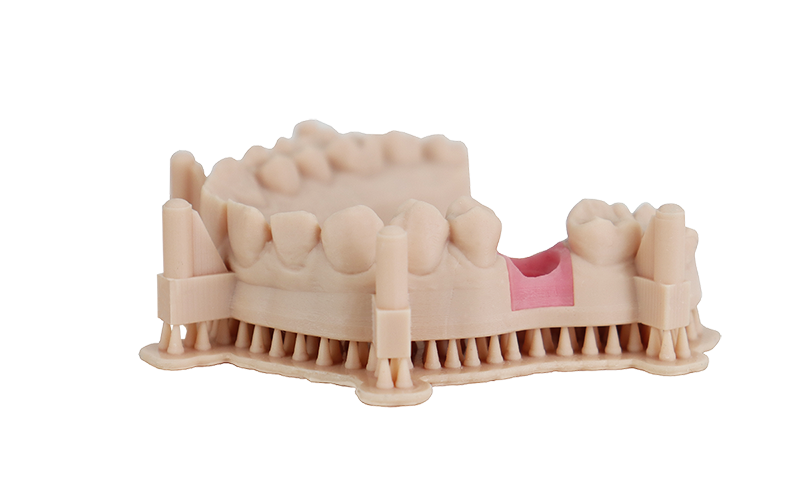 Caso de uso Modelo dental Beige con resina de implante de señal para impresión 3D SLA DLP LCD MSLA