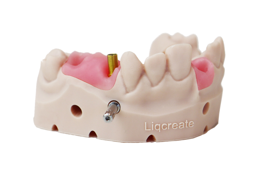 Liqcreate Gingiva Mask Dentalharz zur Herstellung von Zahnimplantatmodellen SLA DLP MSLA LCD