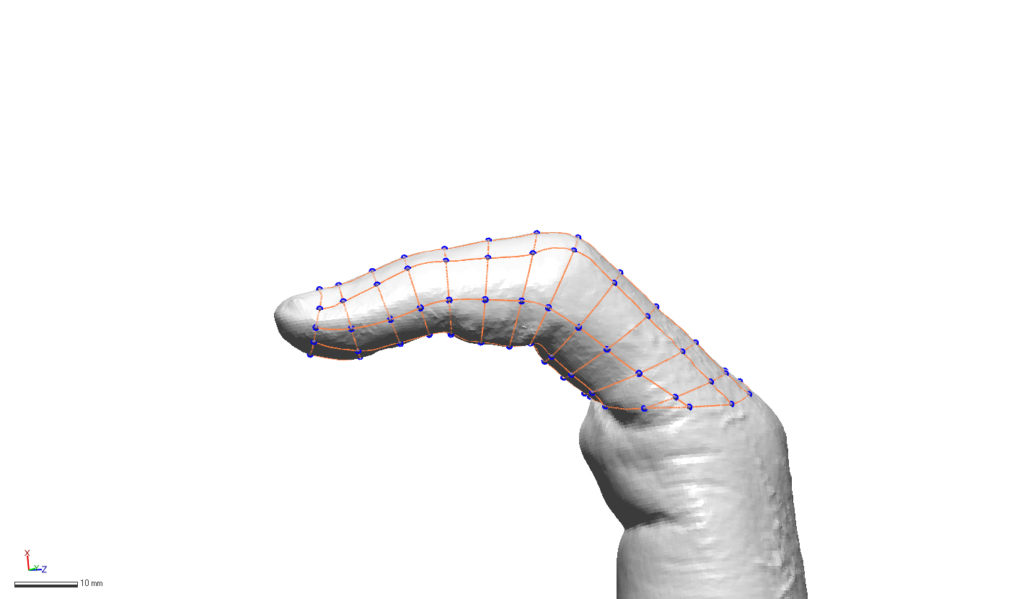 Cattura Schermo1 3DForma 3D-printing resin hand surgery finger splint medical resin liqcreate