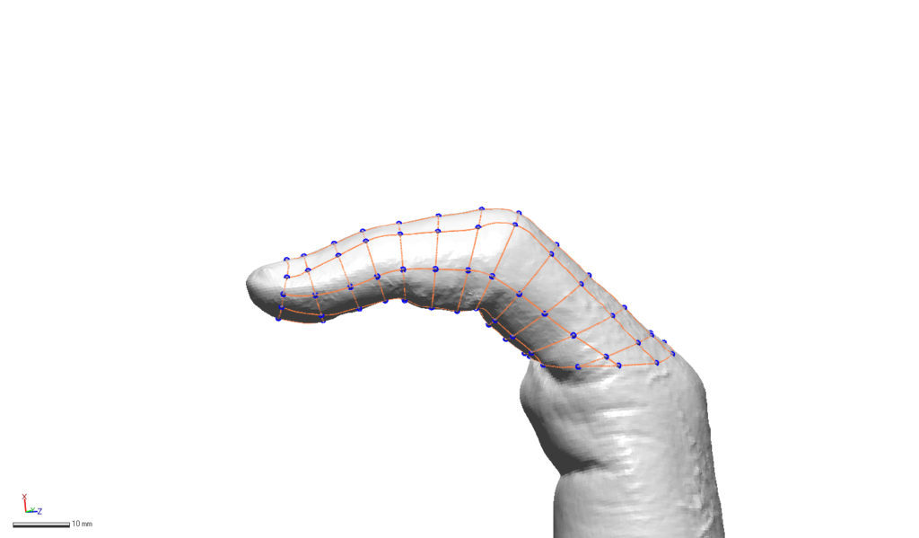 Cattura Schermo1 Cattura Schermo1 3DForma 3D-printing resin hand surgery finger splint medical resin liqcreate