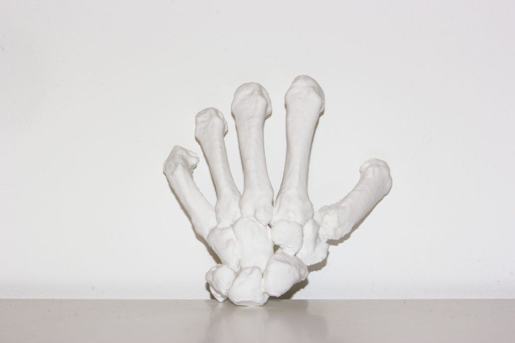 _MG_3017 Cattura Schermo1 3DForma 3D-printing resin hand surgery finger splint medical resin liqcreate CT scan bone
