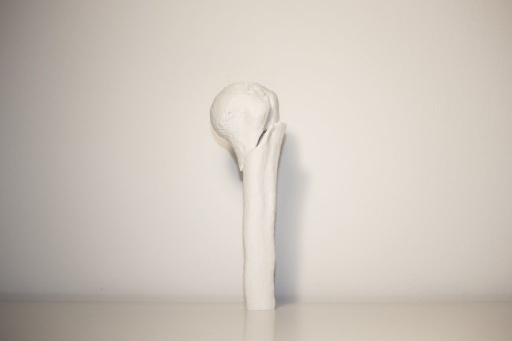 _MG_3129 Cattura Schermo1 3DForma 3D-printing resin hand surgery finger splint medical resin liqcreate CT scan bone