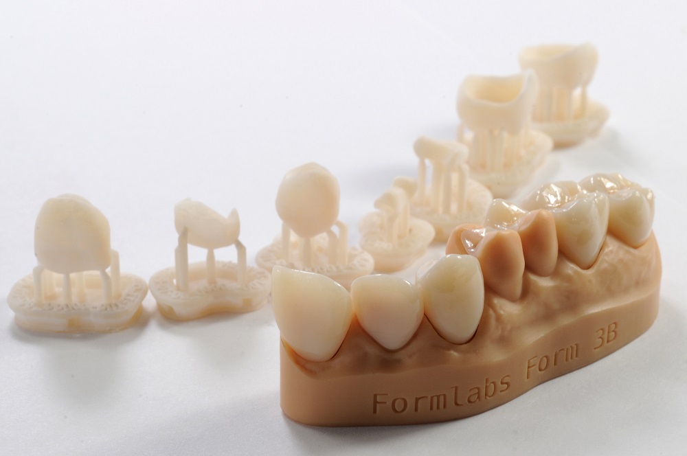 Dental crown and bridge 3D-printing resin dental crowns resin liqcreate engineering dentistry resins digital