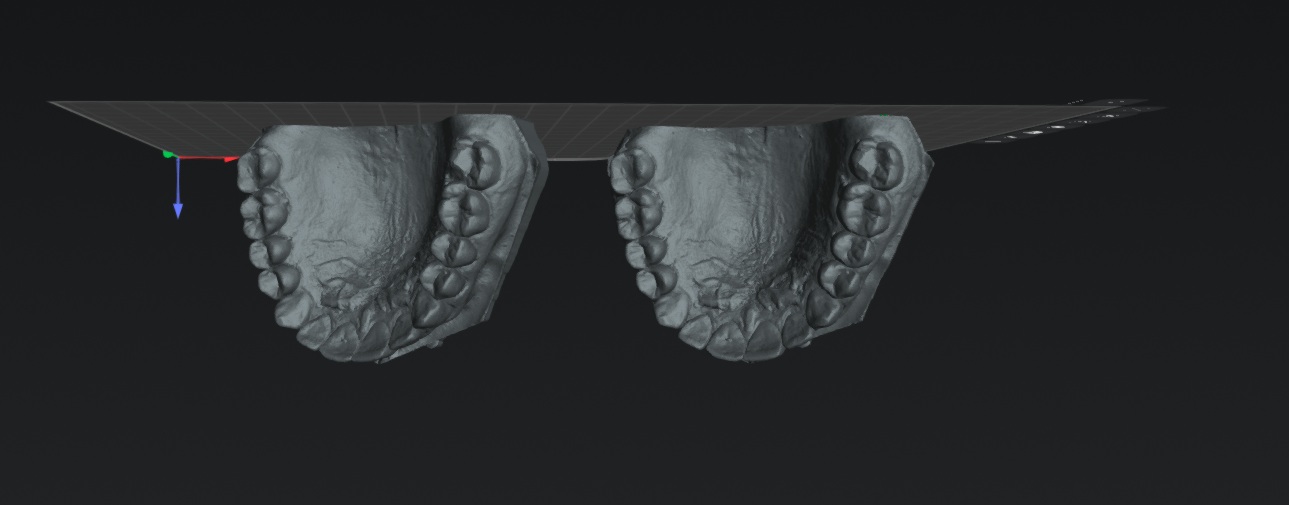 dental models hanging under platform